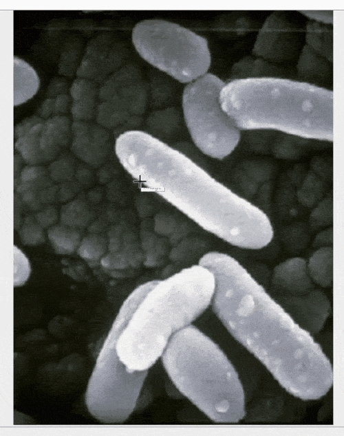 PixelSegmentationofCancerCells