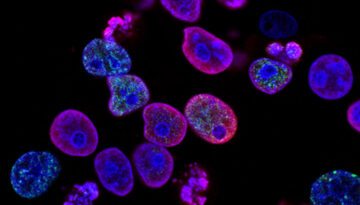 pexel-annoation-1-new