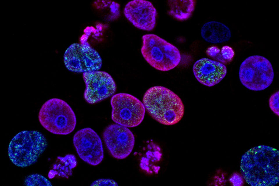 pexel-annoation-1-new pexel-annoation-1-new